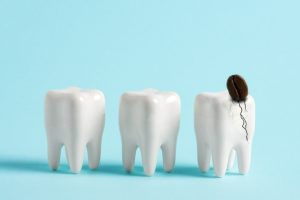 Three white tooth models on blue background, with the rightmost tooth cracked and a coffee bean on top.