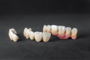 Dental crown restorations displayed showing individual tooth crowns and a bridge on dark background.