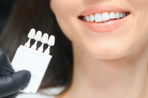 Woman smiling while holding dental veneer shade guide samples showing tooth color options.