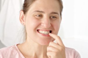 Woman pointing to her teeth while smiling, showing white teeth for dental whitening treatment.