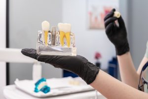 Dentist holding dental implant model showing tooth replacement options and components.