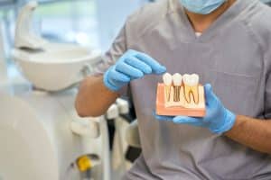 Dentist holding dental implant model showing tooth replacement options in Ruidoso office.